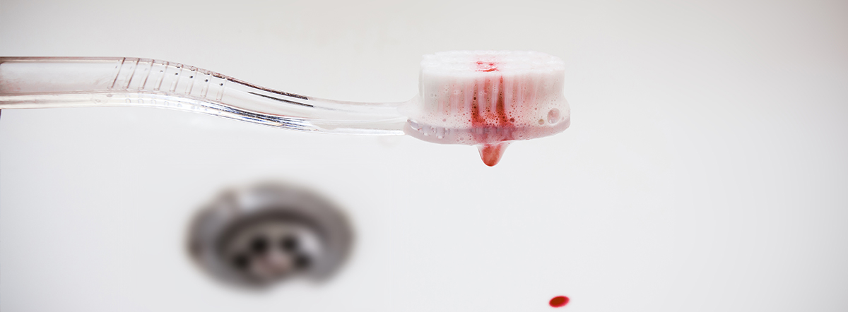 Enfermedades de las Encías
<br>
<small>Signos de advertencia</small>