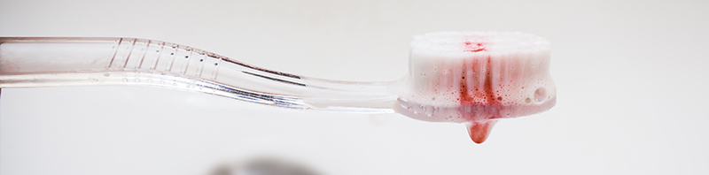 Enfermedades de las Encías
<br>
<small>Signos de advertencia</small>