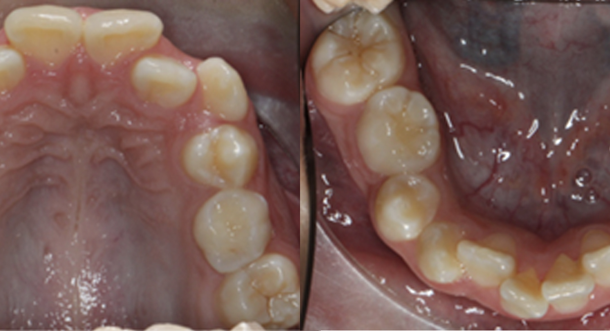 <p>¿Cuándo referir un paciente al Ortodoncista?</p>