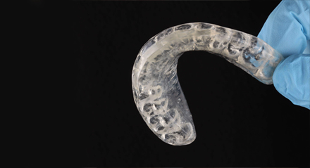 ¿Qué es el guarda oclusal?