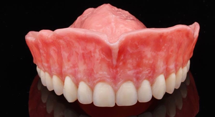 Prótesis Total. Una oportunidad de seguir sonriendo.